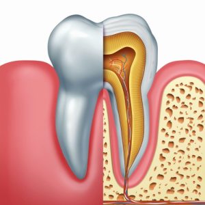 Endodontics (Root Canal)