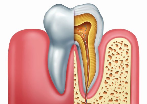 Endodontics (Root Canal)