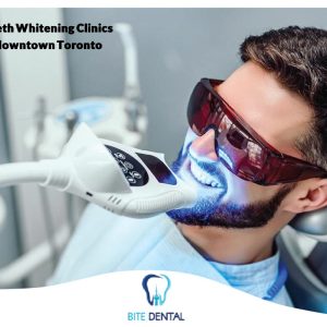 Discover the Top Teeth Whitening Clinics in Downtown Toronto